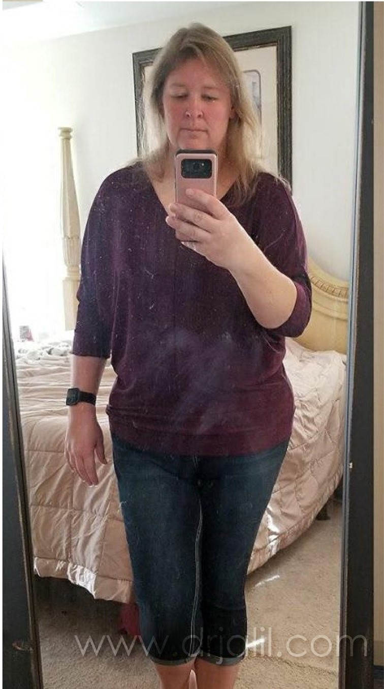 Weight-Loss Surgery