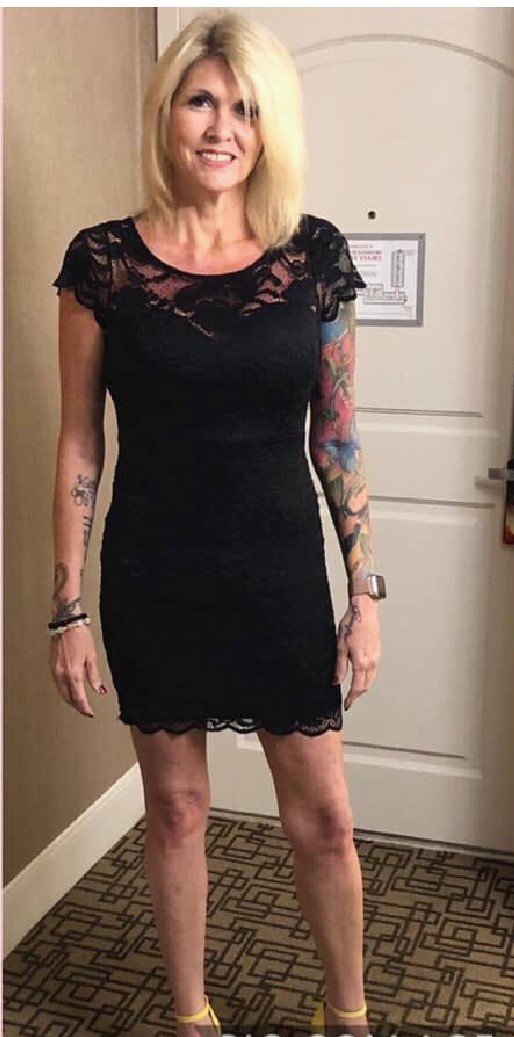 Weight-Loss Surgery