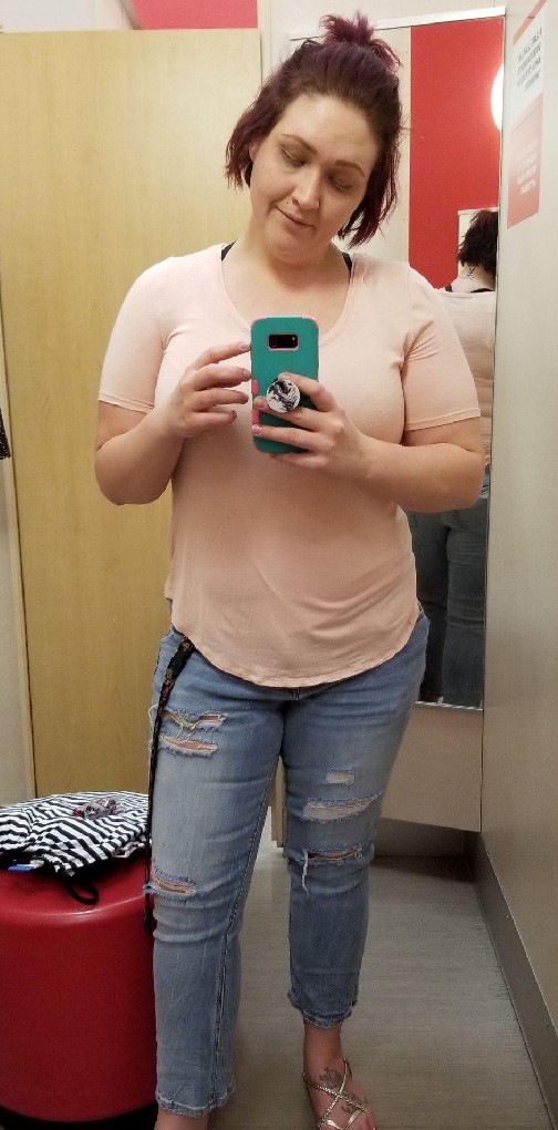 Weight-Loss Surgery