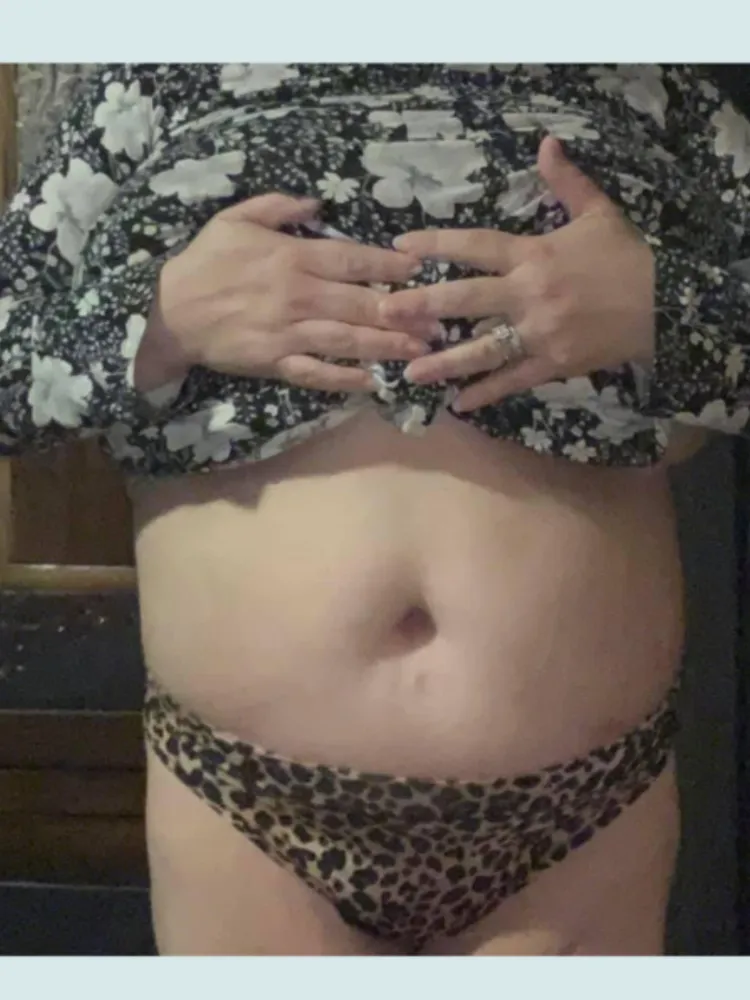 Tummy Tuck