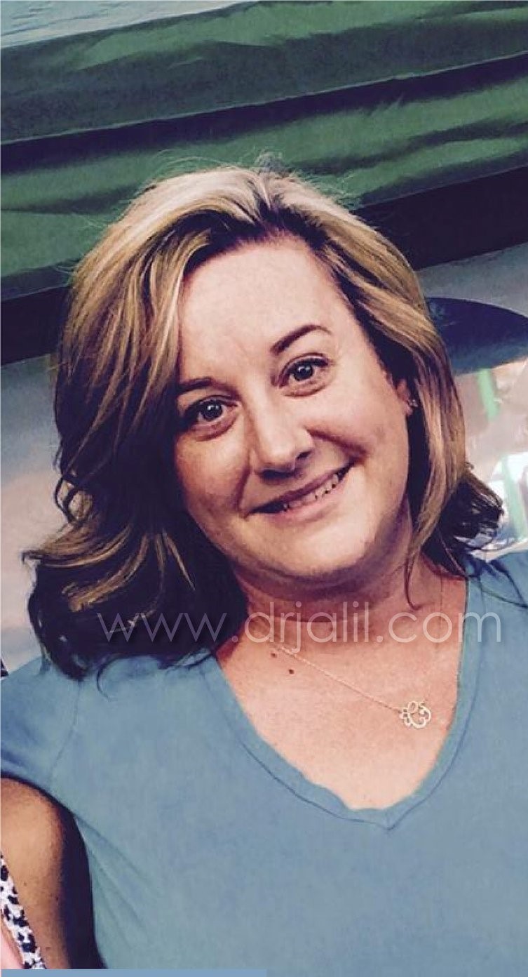 Weight-Loss Surgery