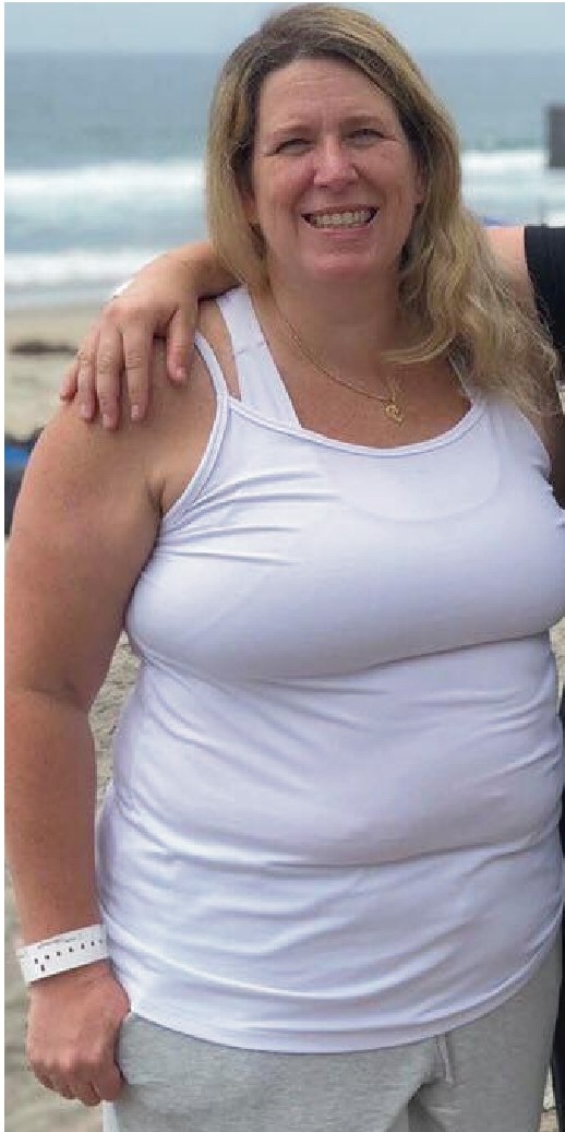 Weight-Loss Surgery