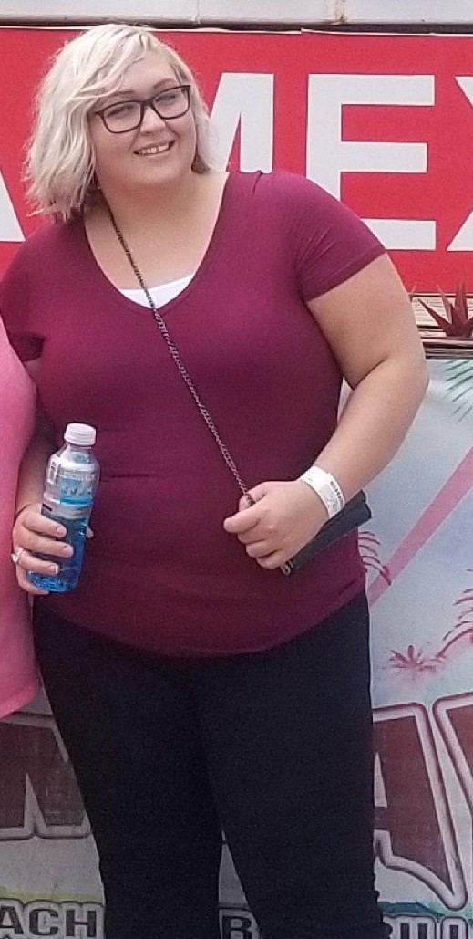 Weight-Loss Surgery